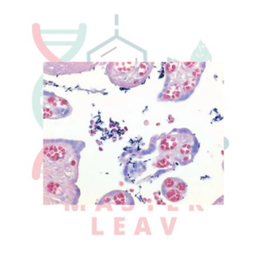 GRAM-COLOR MODIFICADO KIT DE TINCIÓN (SIN FENOL)