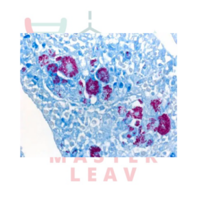 ISOSLIDE™ AFB Control Slides – Portaobjetos de control para bacterias ácido-rápidas