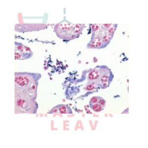 GRAM-COLOR MODIFICADO