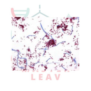 AFB-COLOR CARBOLFUCSINA EN SOLUCIÓN