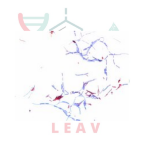 FUCSINA FENICADA SEGÚN ZIEHL-NEELSEN