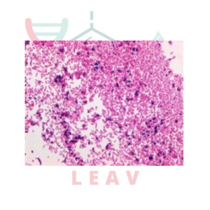 SAFRANINA EN SOLUCIÓN SEGÚN GRAM