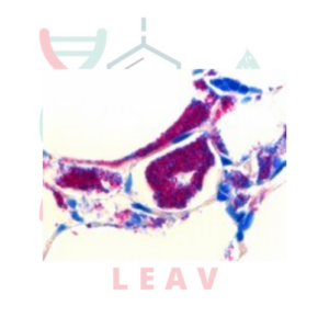 AFB-COLOR KIT DE TINCIÓN